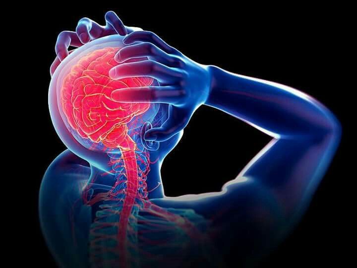 Migraine and Headache Relief and Treatment